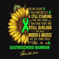 Gastroschisis Awareness She Is A Gastroschisis Warrior She Is Me Iphone 13 Case | Artistshot