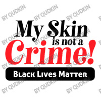 My Skin Is Not A Crime! Women's V-neck T-shirt | Artistshot