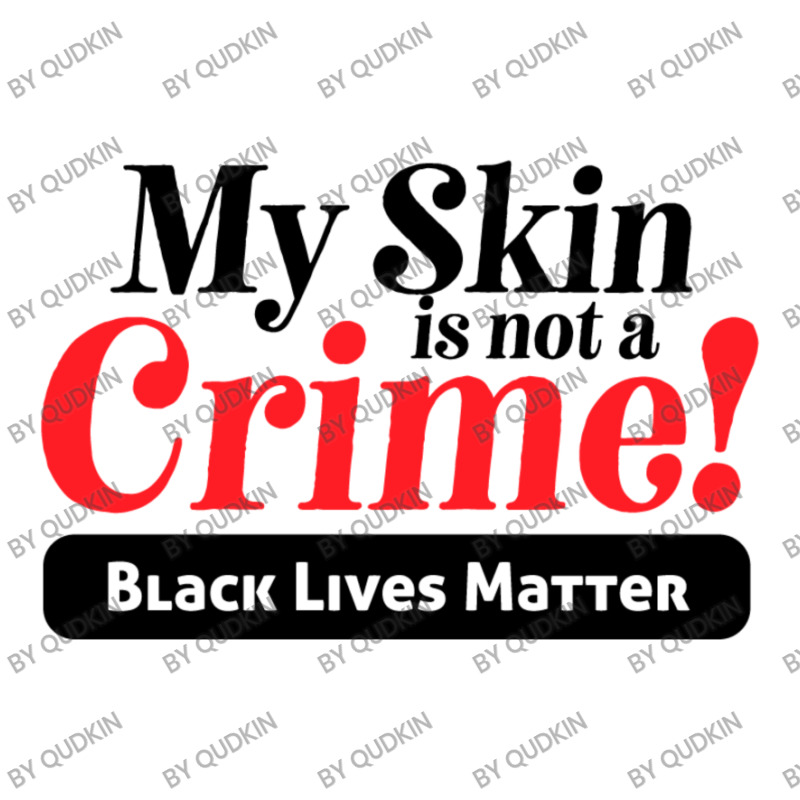 My Skin Is Not A Crime! Women's V-neck T-shirt | Artistshot