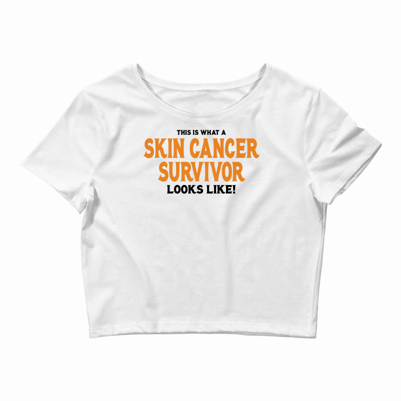 This Is What A Skin Cancer Survivor Looks Like Crop Top | Artistshot