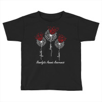 Hemolytic Anemia Awareness Faith Hope Love Dandelion T Shirt Toddler T-shirt | Artistshot