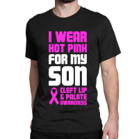 Son  Cleft Palate Gift   Cleft Lip Awareness Classic T-shirt | Artistshot