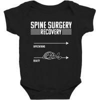 Bionic Spine Replacement Surgery Recovery Spinal F Baby Bodysuit | Artistshot