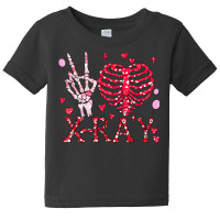 Peace Love X Ray Radiology Tech Happy Valentines D Baby Tee | Artistshot