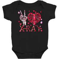 Peace Love X Ray Radiology Tech Happy Valentines D Baby Bodysuit | Artistshot