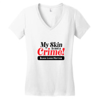 My Skin Is Not A Crime! Women's V-neck T-shirt | Artistshot