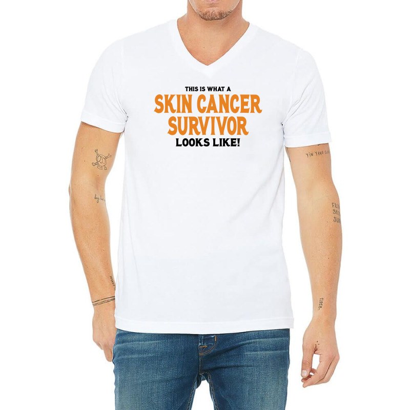 This Is What A Skin Cancer Survivor Looks Like V-neck Tee | Artistshot