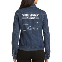 Bionic Spine Replacement Surgery Recovery Spinal Fusion T Shirt Ladies Denim Jacket | Artistshot