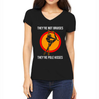 Theyre Not Bruises Women's V-neck T-shirt | Artistshot