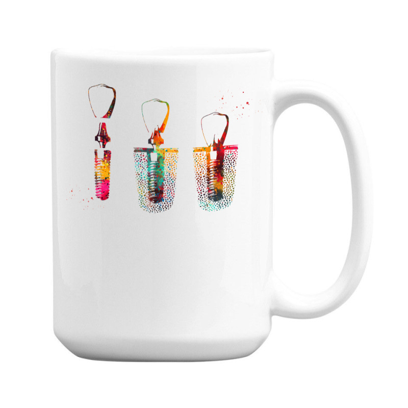 Dental Implant Procedure 15 Oz Coffee Mug | Artistshot