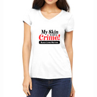 My Skin Is Not A Crime! Women's V-neck T-shirt | Artistshot