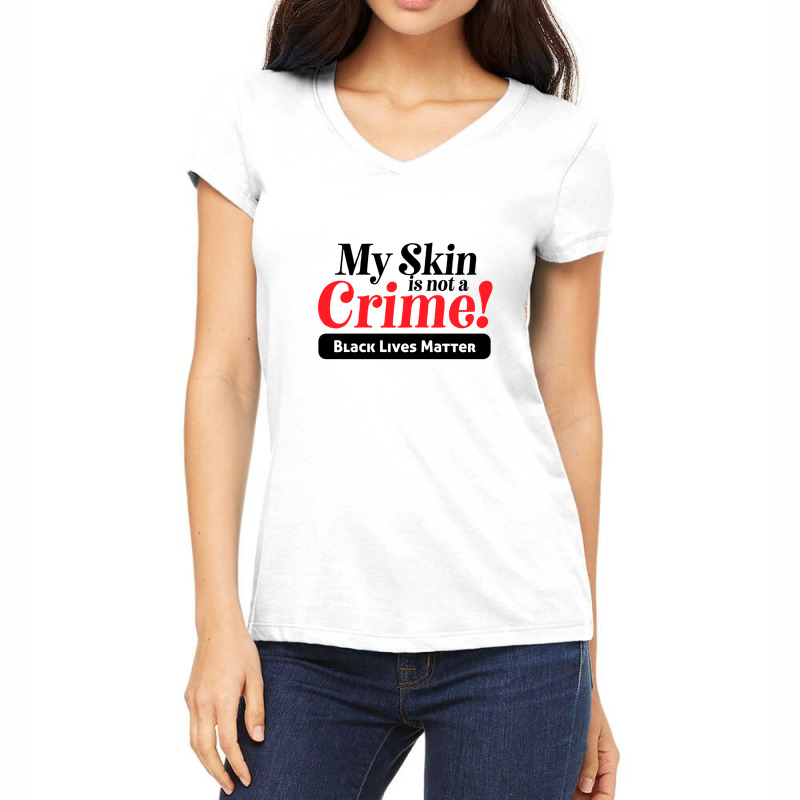 My Skin Is Not A Crime! Women's V-neck T-shirt | Artistshot