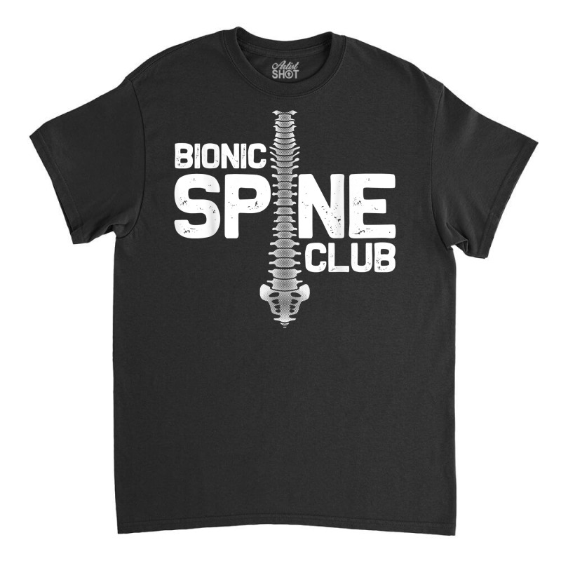 Funny Spine Surgery Gift For Men Women Bionic Spine Club T Shirt Classic T-shirt by mikidicosmo | Artistshot